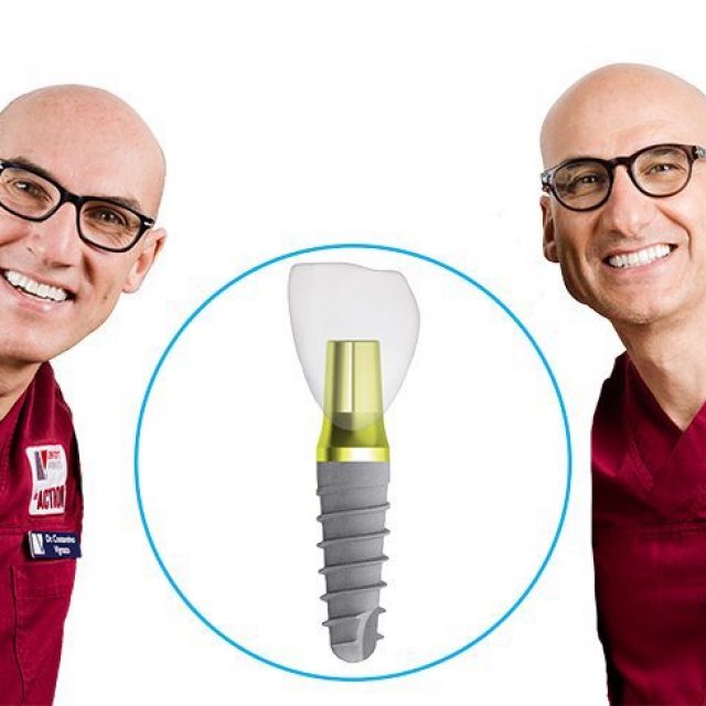 Choose rehabilitation on implants today to smile tomorrow too